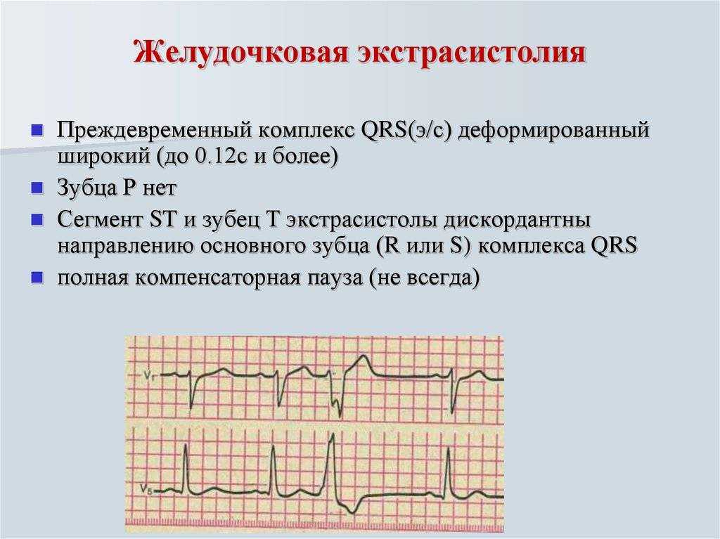 Аритмия - нарушение ритма сердцебиения у собак | ваши питомцы