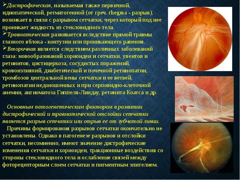 Выбираем комплекс с лютеином для глаз