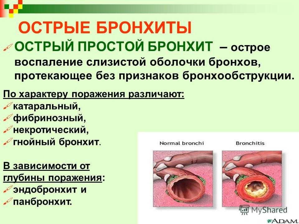 Бронхит у собак: симптомы, вирусный и хронический, лечение, в т.ч. антибиотиками - блог о животных - zoo-pet.ru