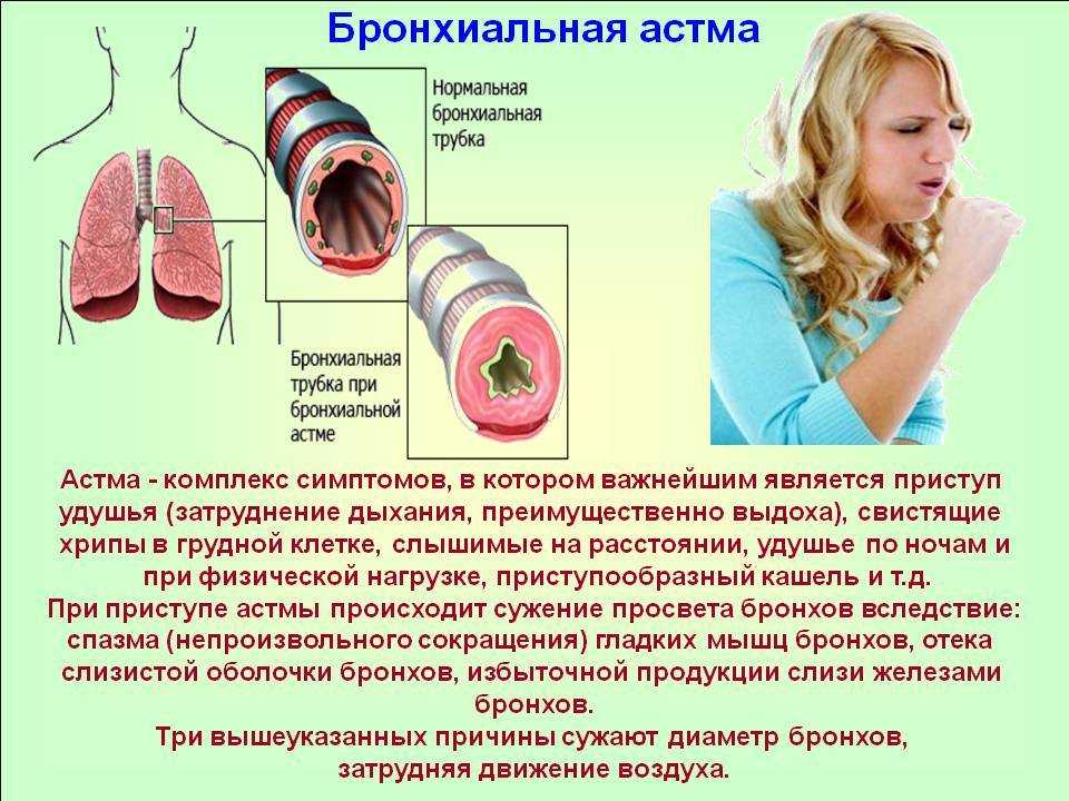 Как вылечить сопли у собаки
