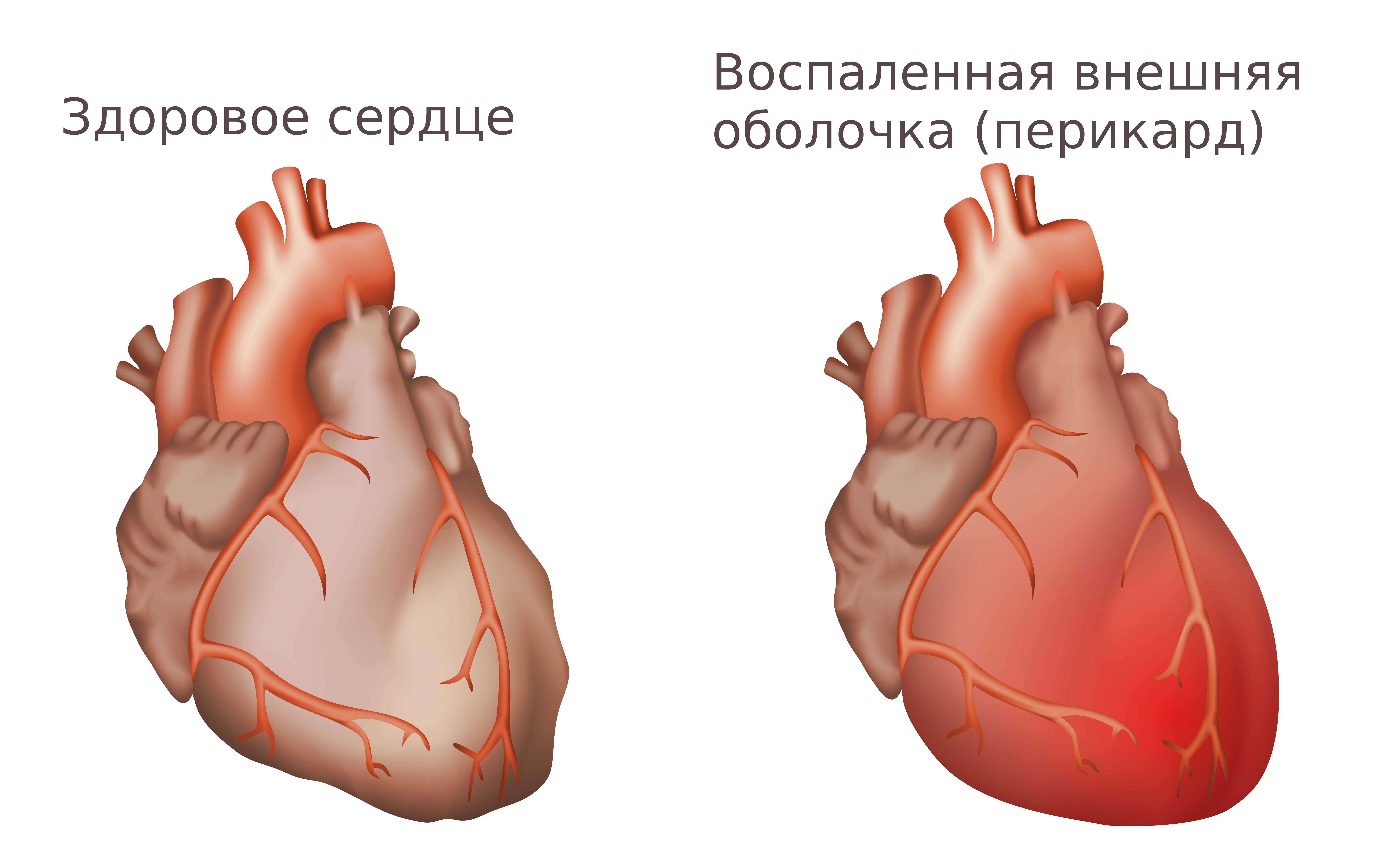 Перикардит у собак: симптомы и лечение | как лечить