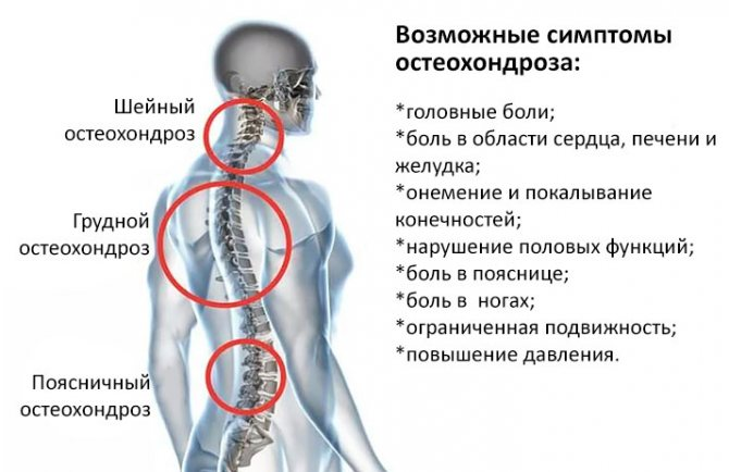 Кифоз. методы лечения кифоза, симптомы, причины, диагностика | центр дикуля