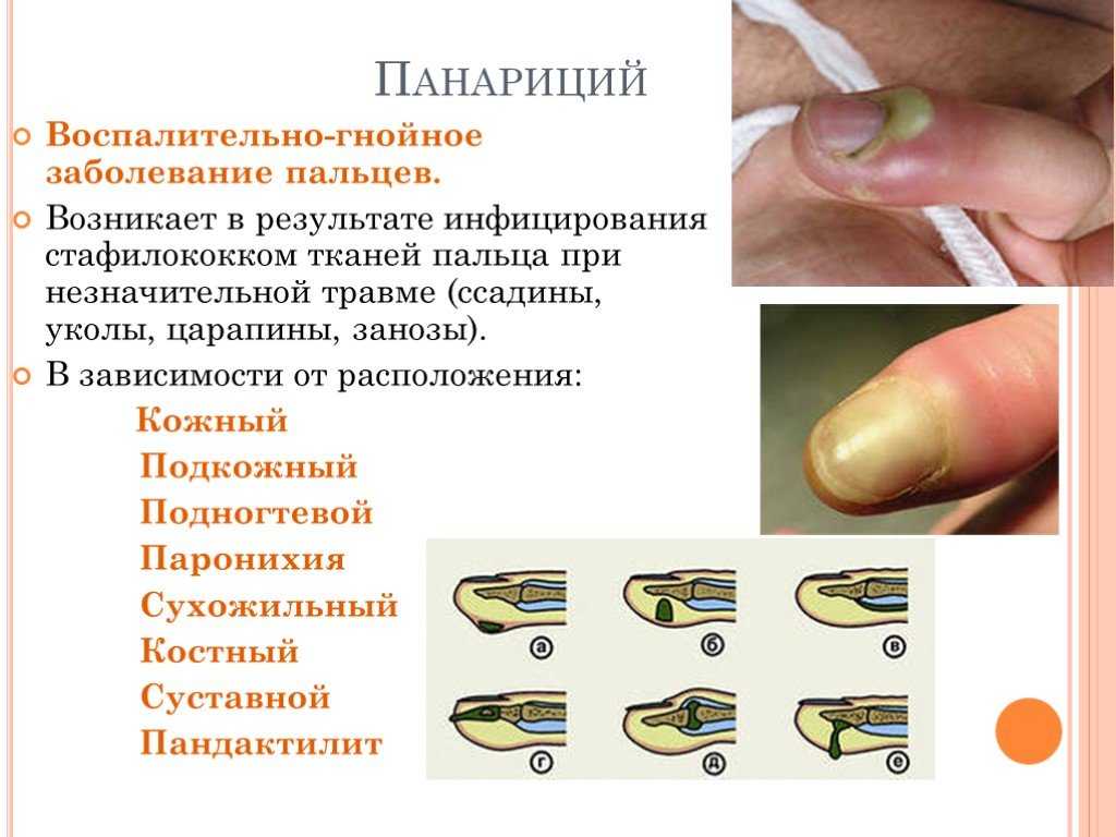 Нередки случаи когда питомец возвращается с прогулки с поврежденным когтем Как помочь собаке в этом случае рассмотрим далее