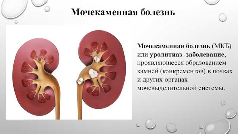 Симптомы и лечение мочекаменной болезни у кошек лептоспироз (желтуха)  это острое инфекционное заболевание.