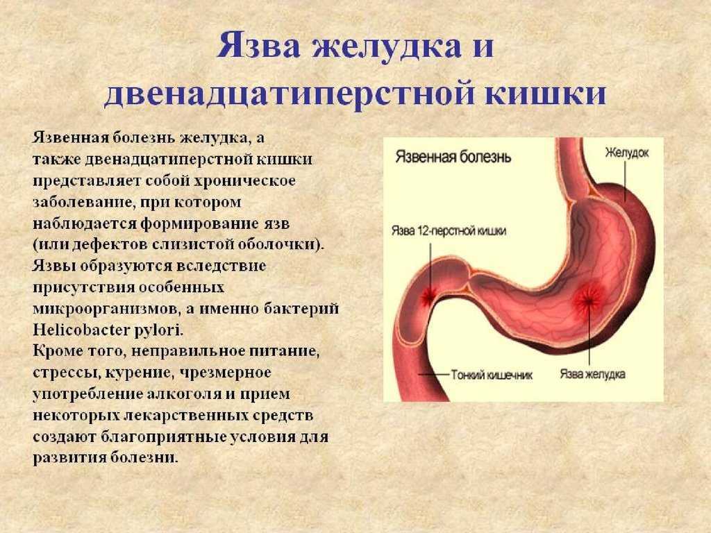 Язва желудка у собак: причины, симптомы, лечение, профилактика