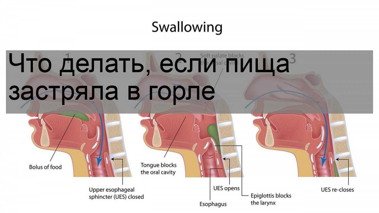 Что делать, если собака съела кости