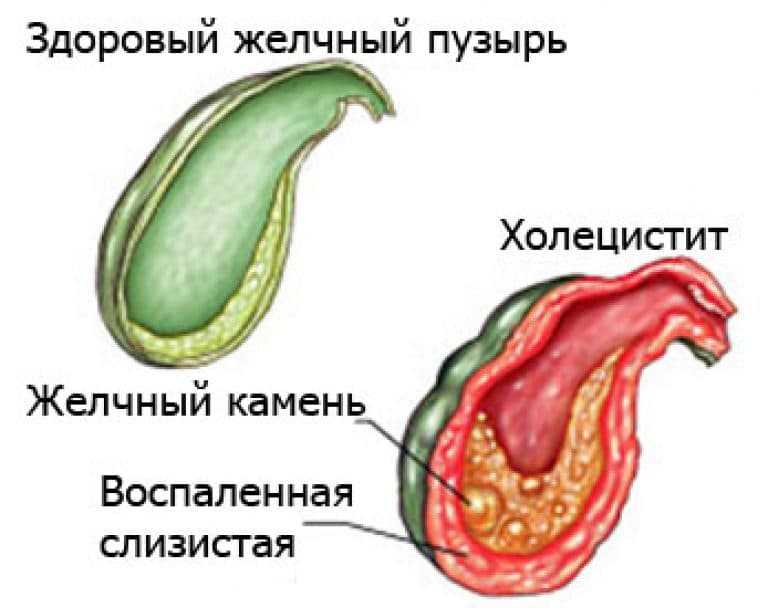 Холецистит у собак - ветеринарный госпиталь