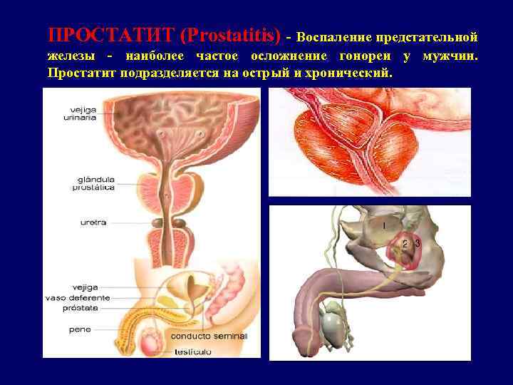 Простатит у животных (собак и кошек). лечение в россии