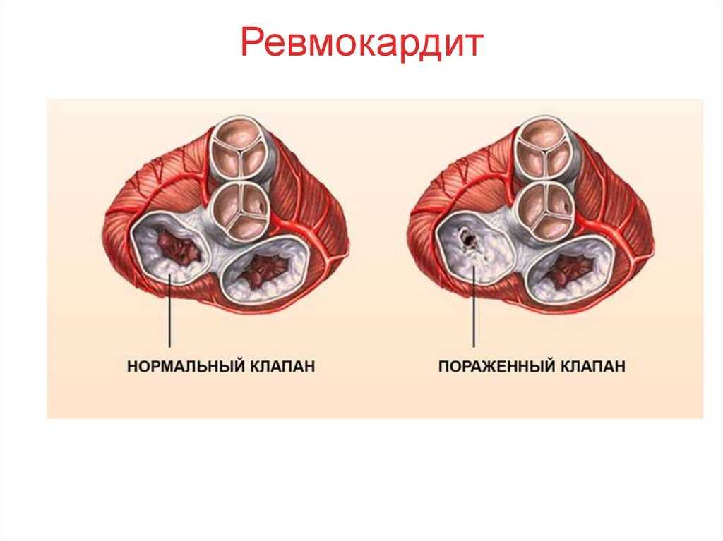 Артрит у собаки