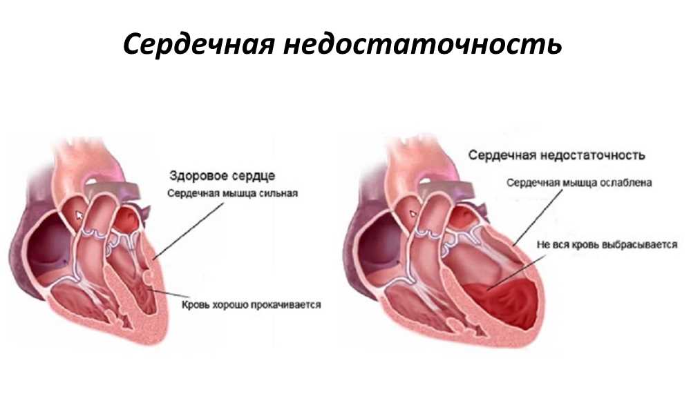 Болезни сердца. болезни собак (незаразные)