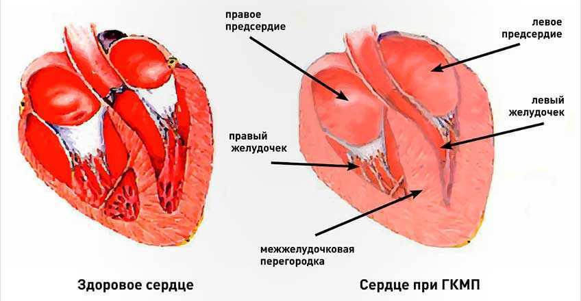 Эндокардиоз митрального клапана у собаки - «айболит плюс» - сеть ветеринарных клиник