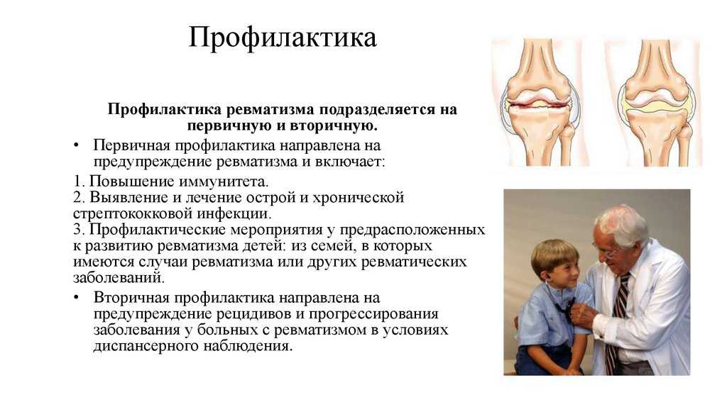 Ревматическая атака у собак. артрит у собаки: причины, симптомы, лечение. причины возникновения ревматизма у собак