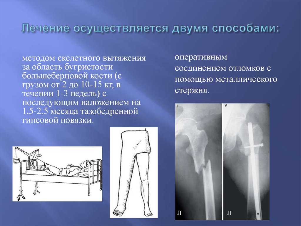 Перелом у собаки: как определить, как лечить