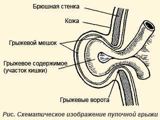 Пупочная грыжа у собак: фото, лечение, что делать?