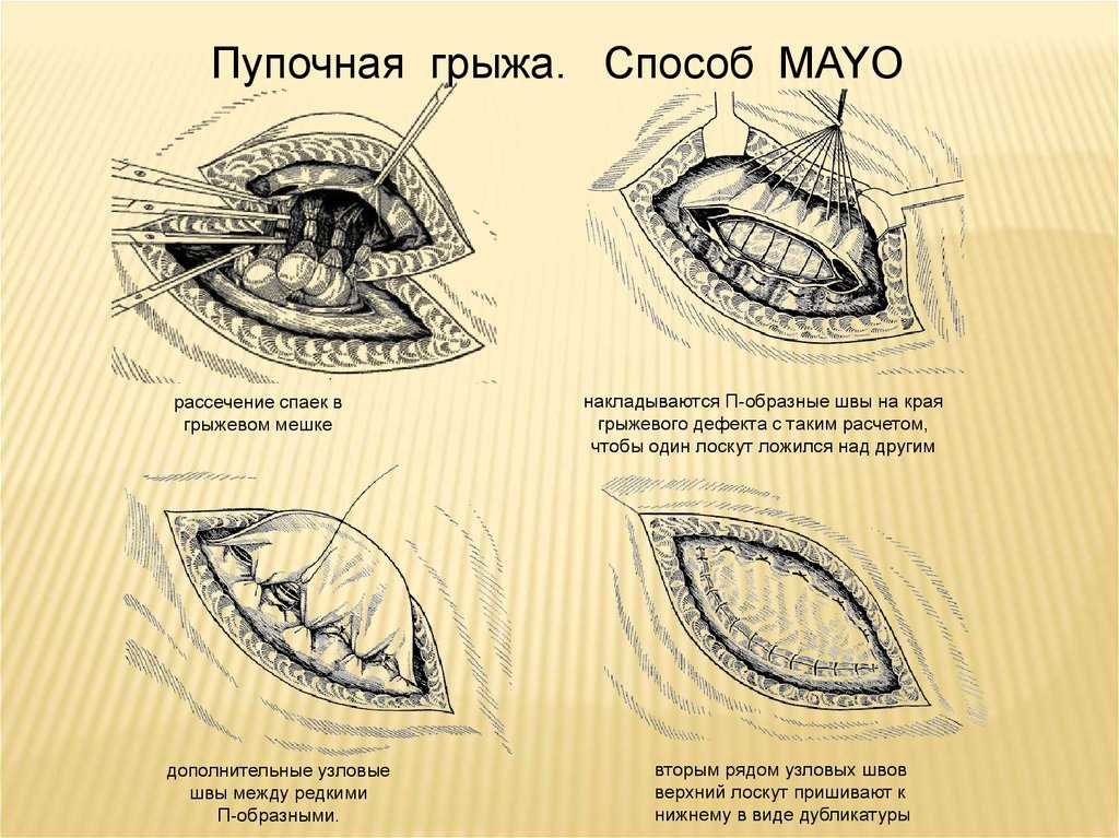 Грыжа у собаки: пупочная, на животе, операция, лечение, удаление - zoosecrets